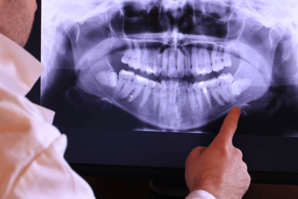 Best Pediatric Emergency Dentist in Lannon, WI